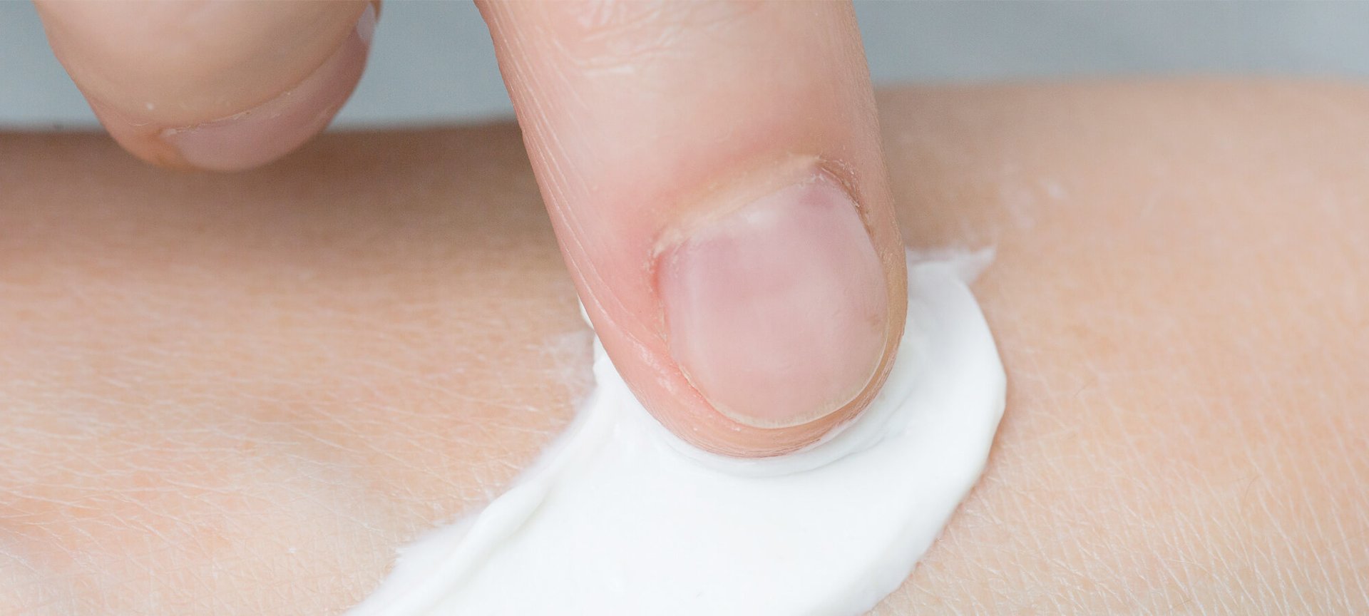 5 huidverzorgingstips om een gevoelige huid te kalmeren hero