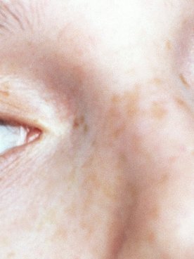 Hoe kies je de juiste concealer tegen donkere kringen?