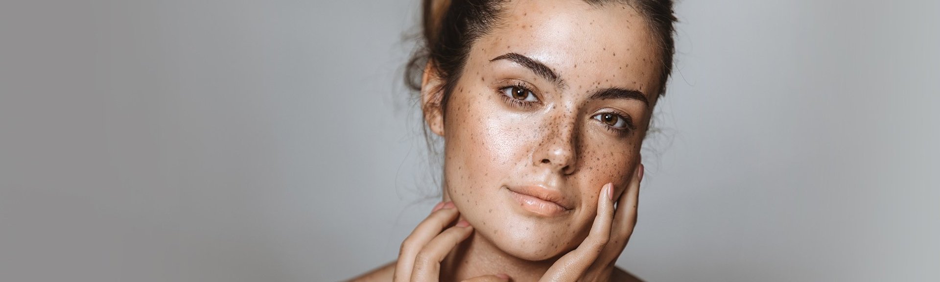 220607 Hero Content Pigmentflecken Hero 2000x900px