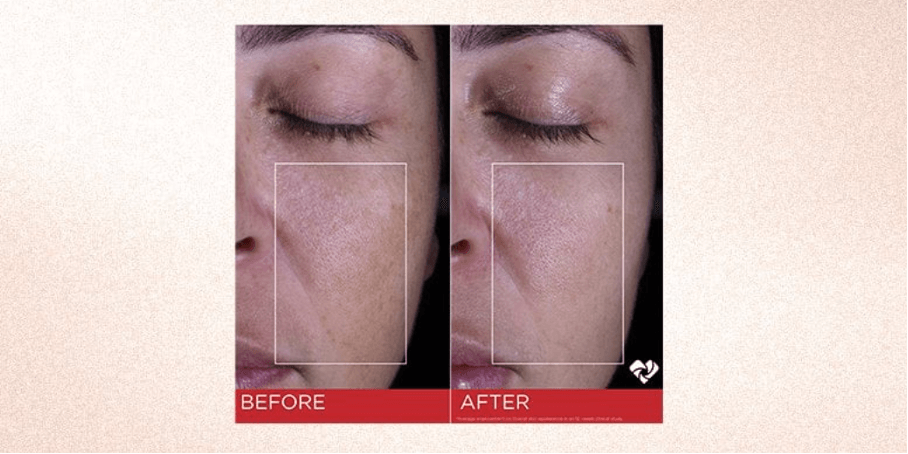 Hoe Gebruik Je Retinol Als Je In De Dertig Bent