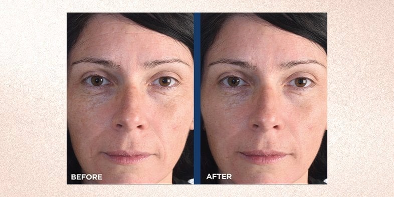 InArticlewhenshouldyoustartusingretinolRevitaLift Retinol  Niacinamide Pressed Night Cream