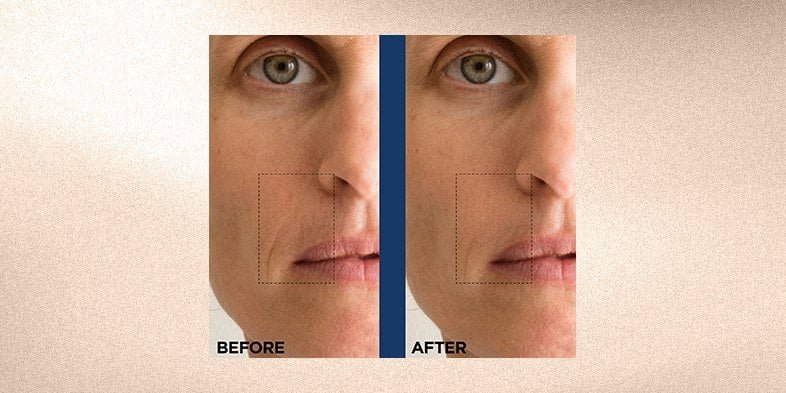 In Article How Does Retinol Work 2