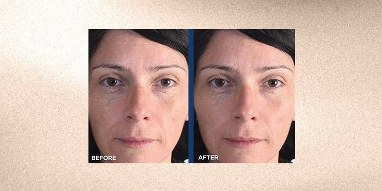 In Article How Does Retinol Work 3