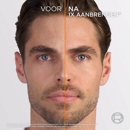 T4 NL