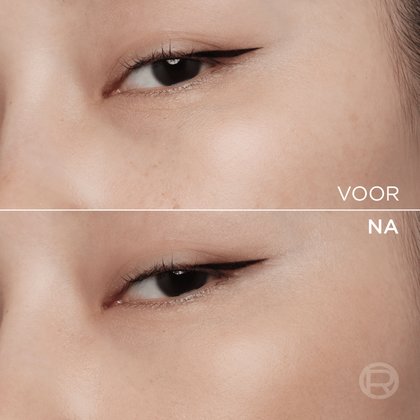 3600524242473 4NL