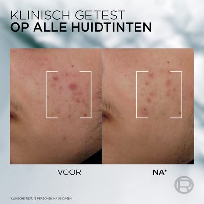 3600524202651 3 NL